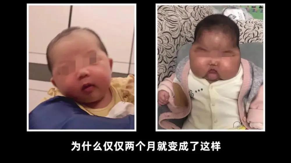 “大頭娃娃”再現(xiàn)引熱議，父母應該知道茶油對孩子有多好